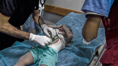 Dünya Sağlık Örgütü: Gazze'de herkes aç, çoğu açlıktan ölüyor - Son Dakika Haberleri